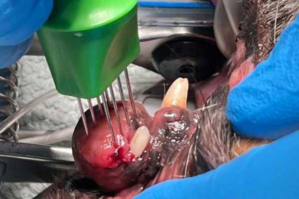 Administration d'un produit cytotoxique sous anesthésie avant la séance d'électro-chimiothérapie. Traitement avec une électrode à aiguilles.